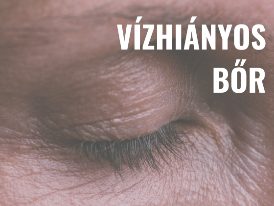 Vízhiányos bőr - Timi bőrének története